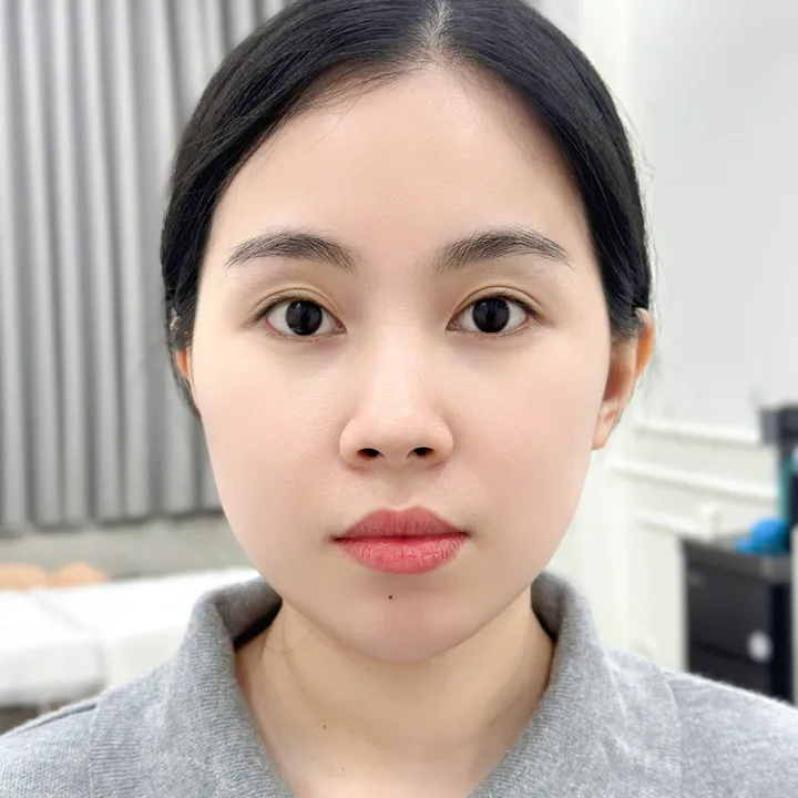 Fox Brows Shading — cả gương mặt — trước khi làm tại KIMLY
