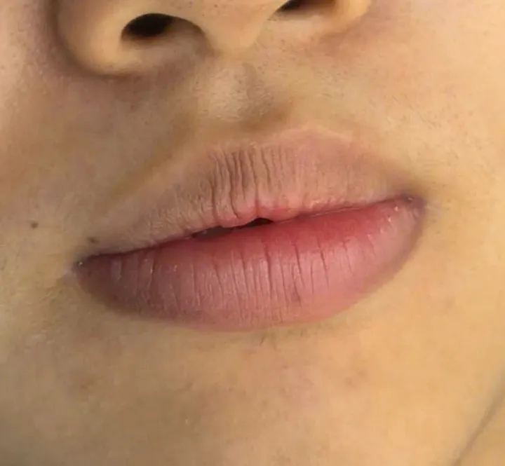 Sketchlips — trước khi làm tại KIMLY